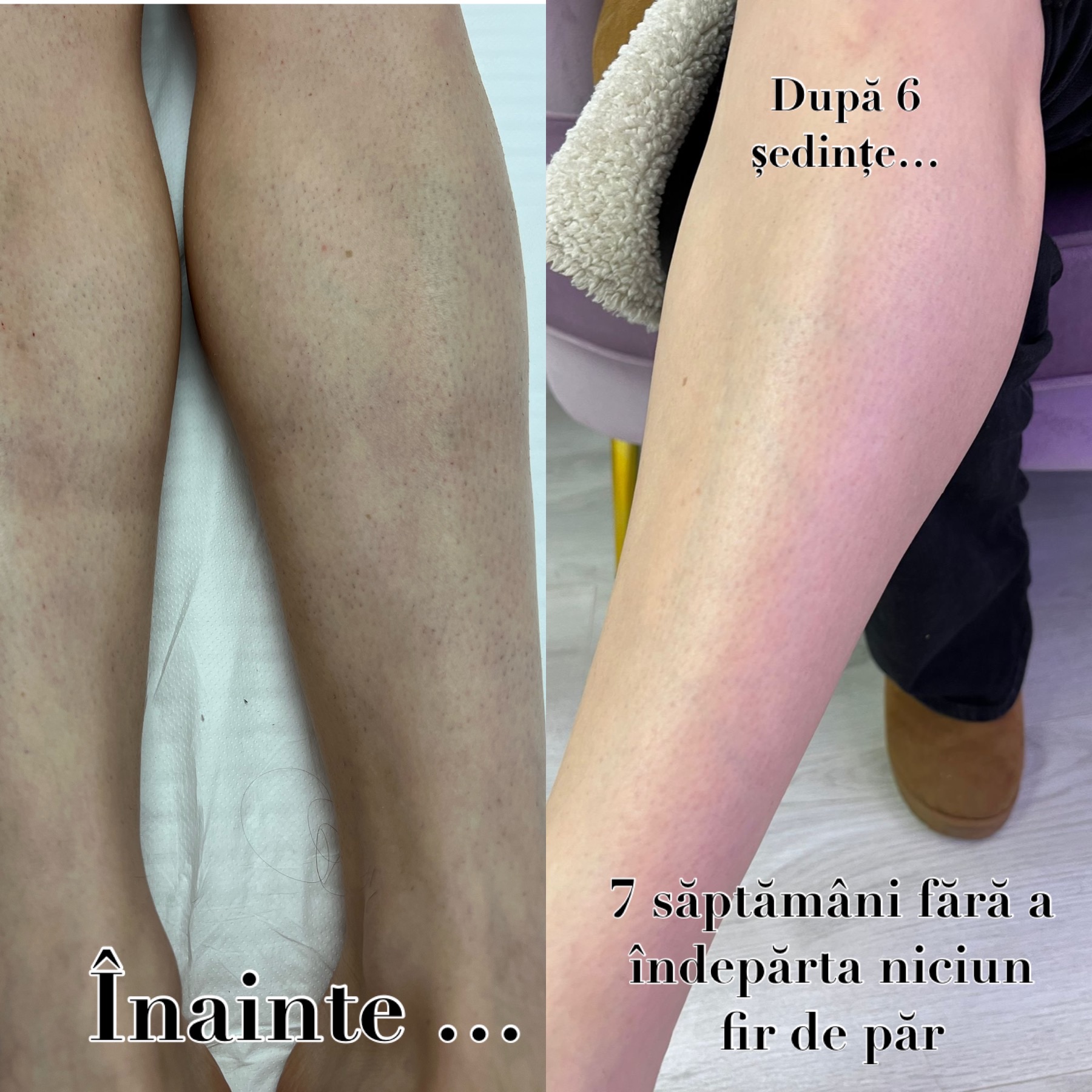 elysion rezultate 13